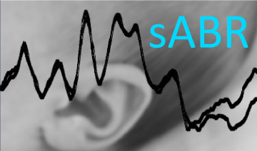 Now Available: sABR Software